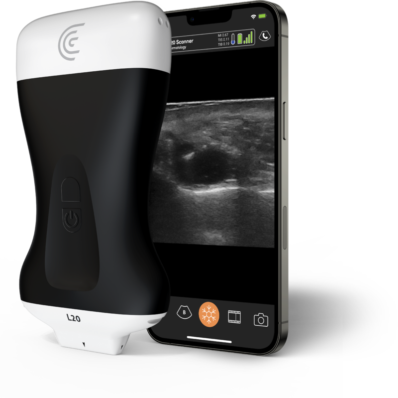 Product-L20-Ultra-High-Freq-Linear-Handheld-Portable-Wireless-Ultrasound-Scanner-small