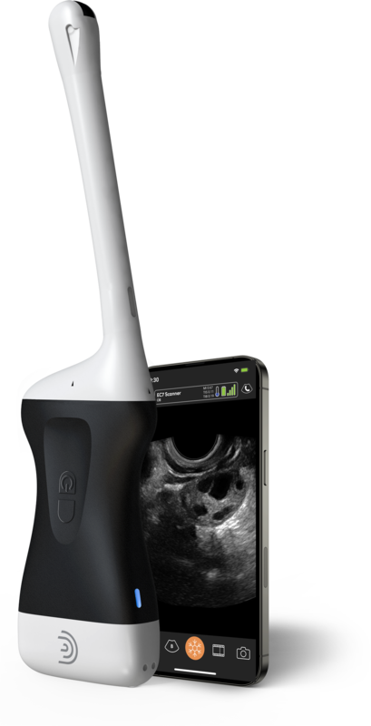 Product-EC7-Endocavity-Handheld-Portable-Wireless-Ultrasound-Scanner-small
