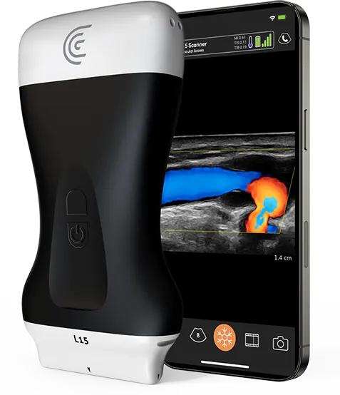 Product-L15-Handheld-Ultrasound-for-Vascular-Access