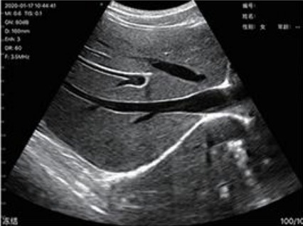 WhatsApp Image 2026-01-13 at 18.57.42