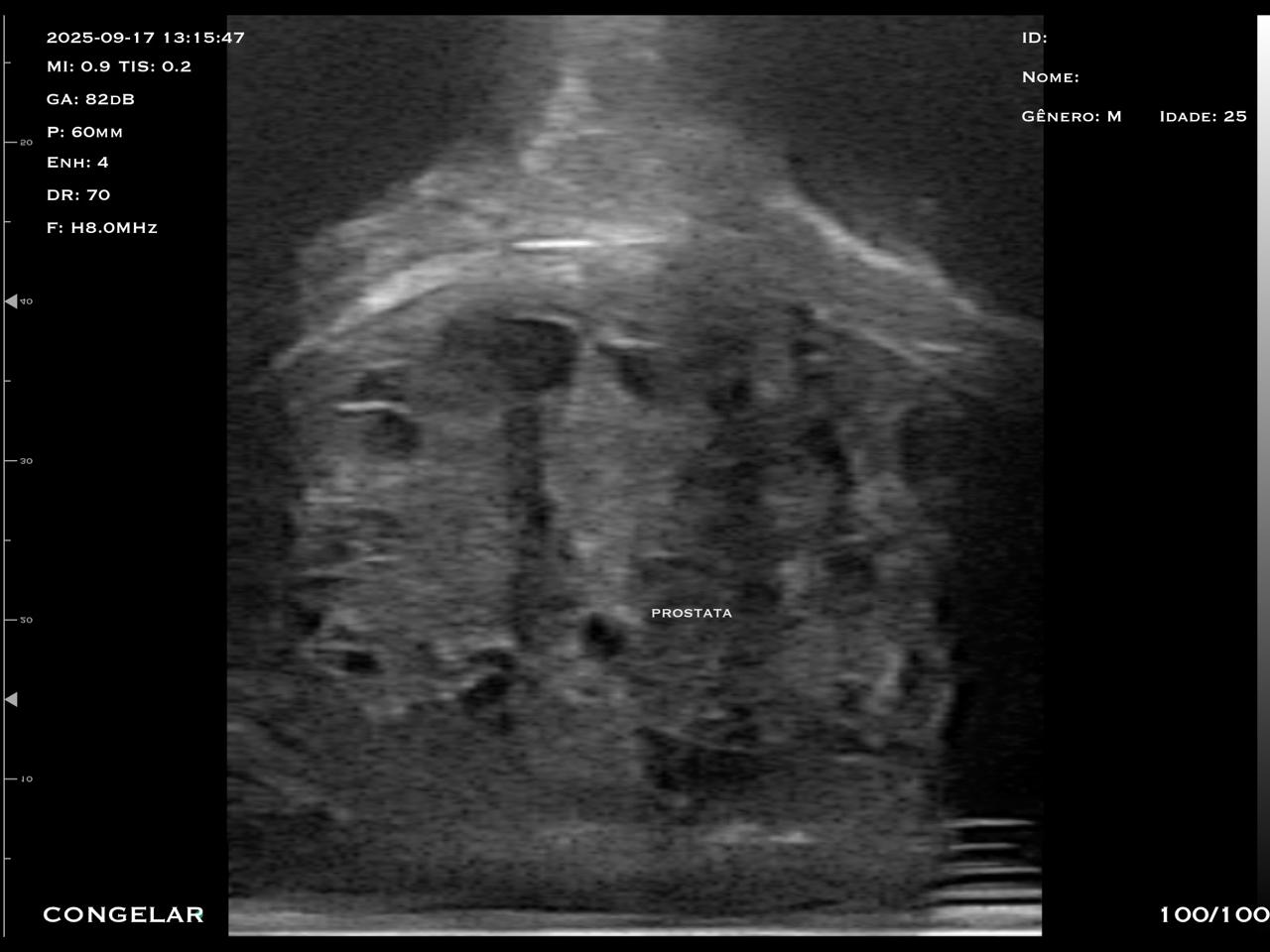 prostata-me-biplanar-2