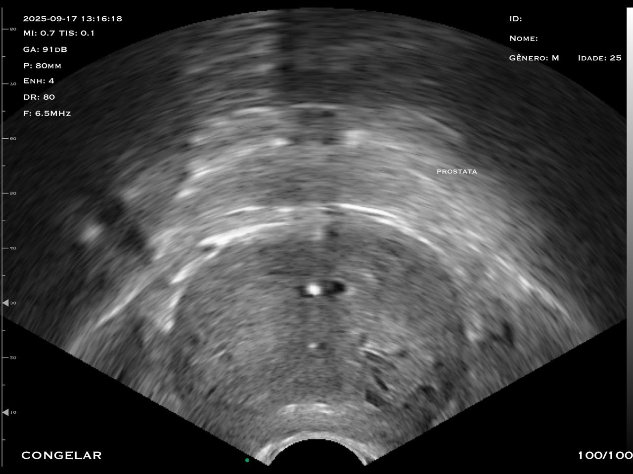prostata-me-biplanar1